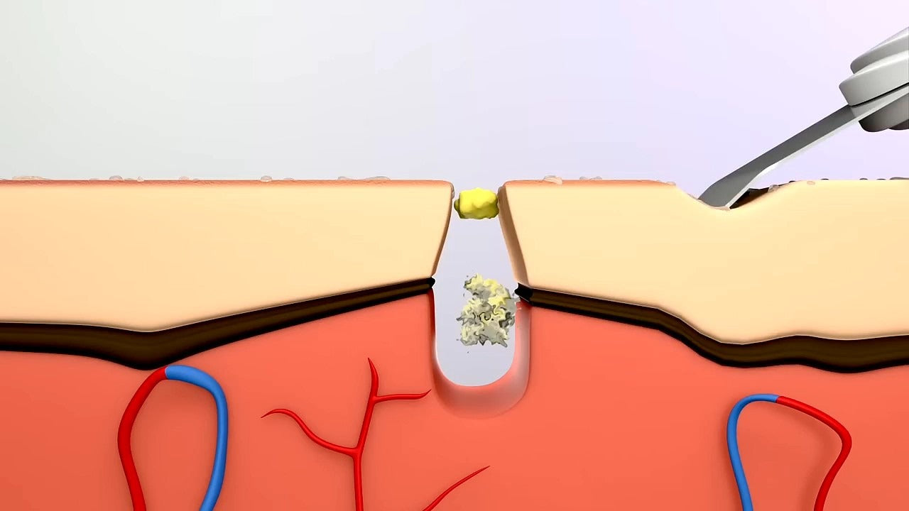 Ultrasonic Skin Scrubber & Facial Cleaning