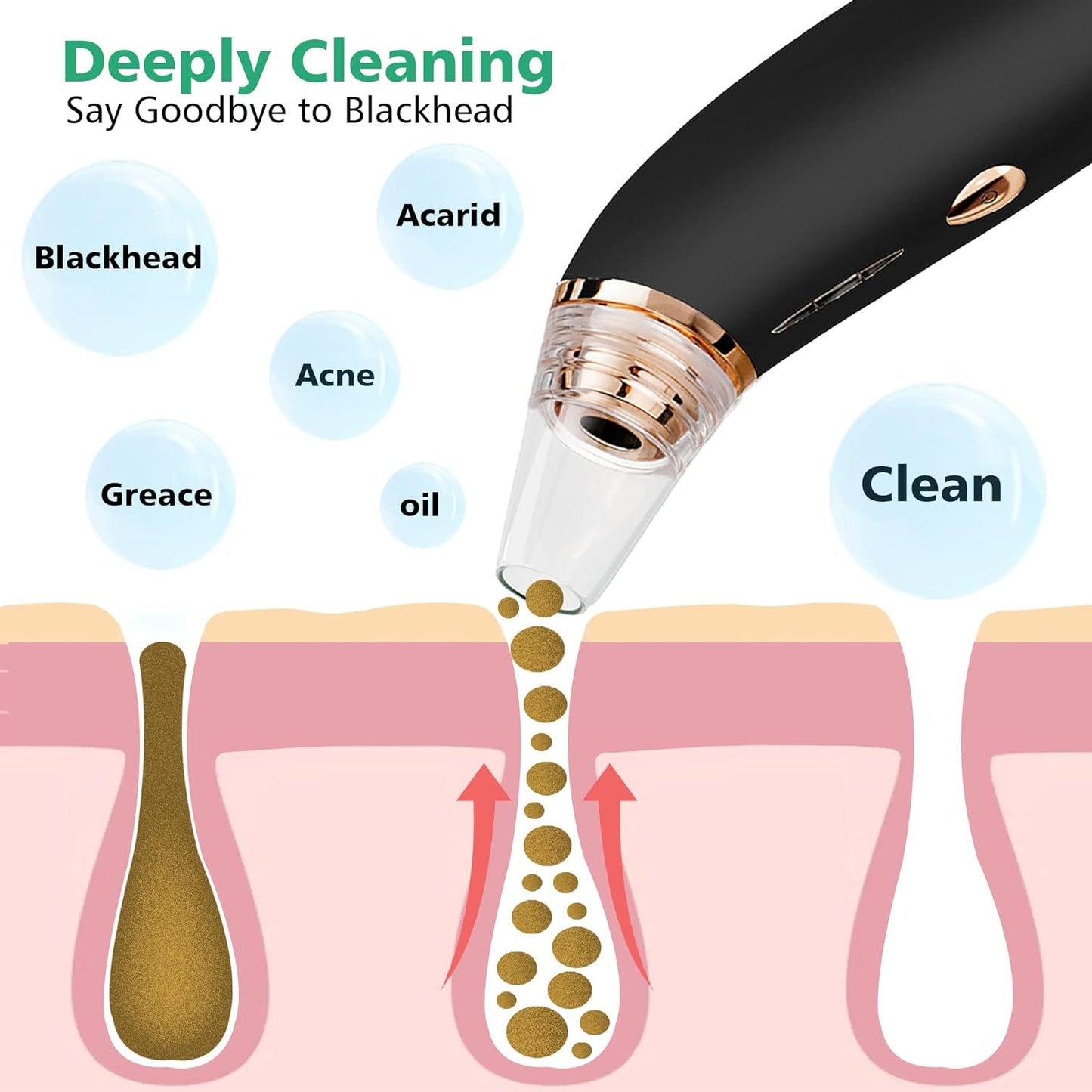 Black Head Removal Derma Suction Machine