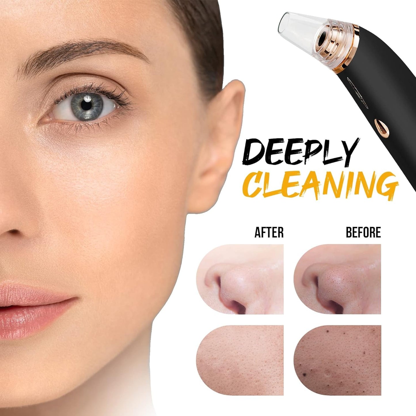 Black Head Removal Derma Suction Machine